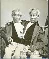 Siamese twins dotee